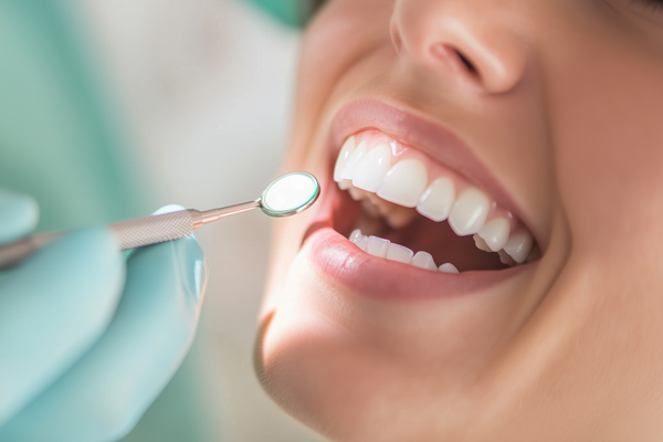 Professionelle Zahnreinigung bei einer Frau
